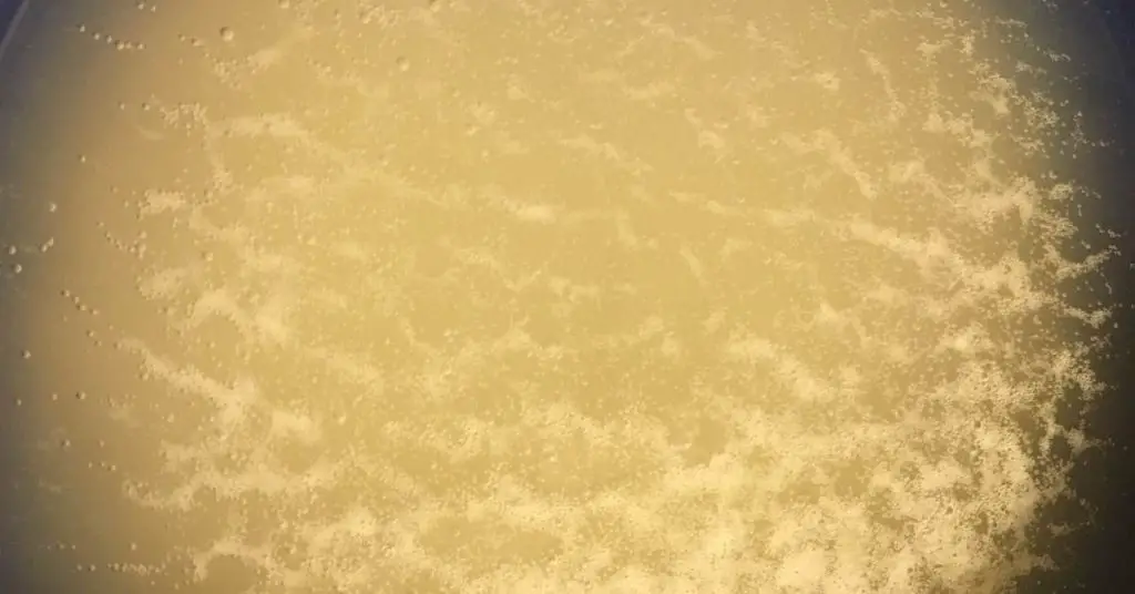 How Much Yeast Do You Put In Pizza Dough? An Expert Answers. 1 76 How Much Yeast Do You Put In Pizza Dough? An Expert Answers.